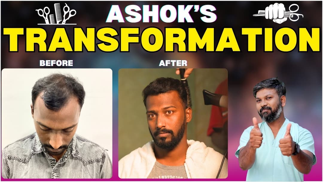 Ashok’s Hair Transformation: What We Can All Learn from Dr. John Watts