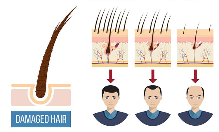 Hair Loss Causes | Best Hair Solutions