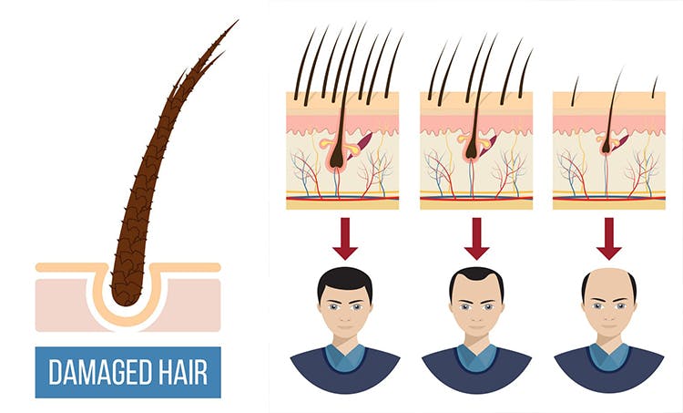 Trichos Solution For Hair Loss Causes