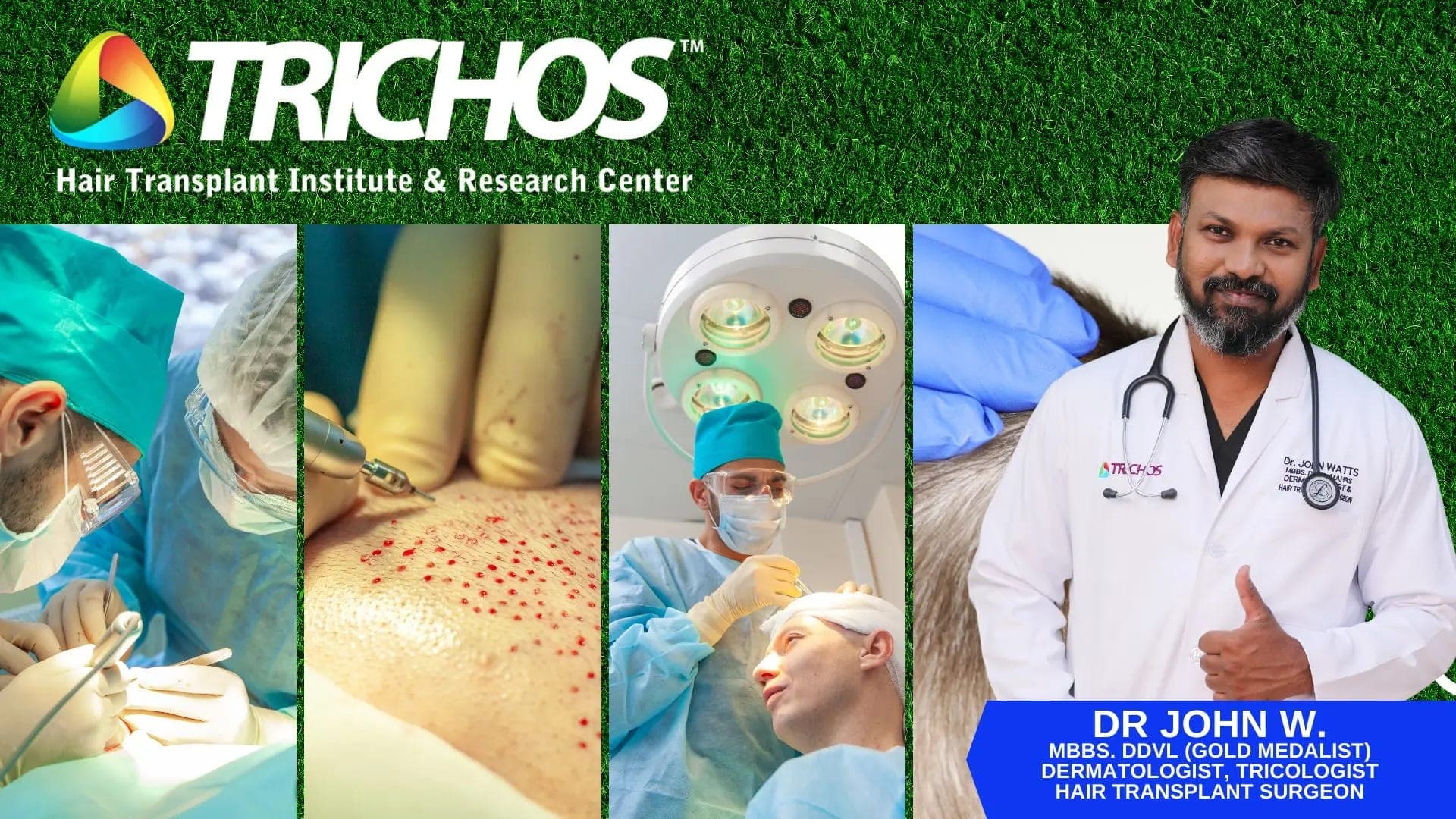 Best Hair Transplant Center in Hyderabad