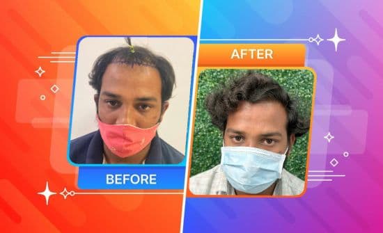 Trichos Before After