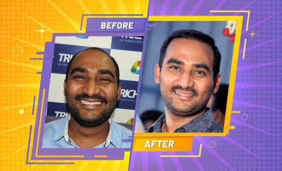 Trichos Before After