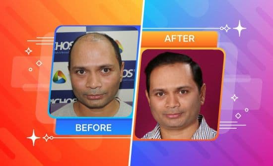 Trichos Before After