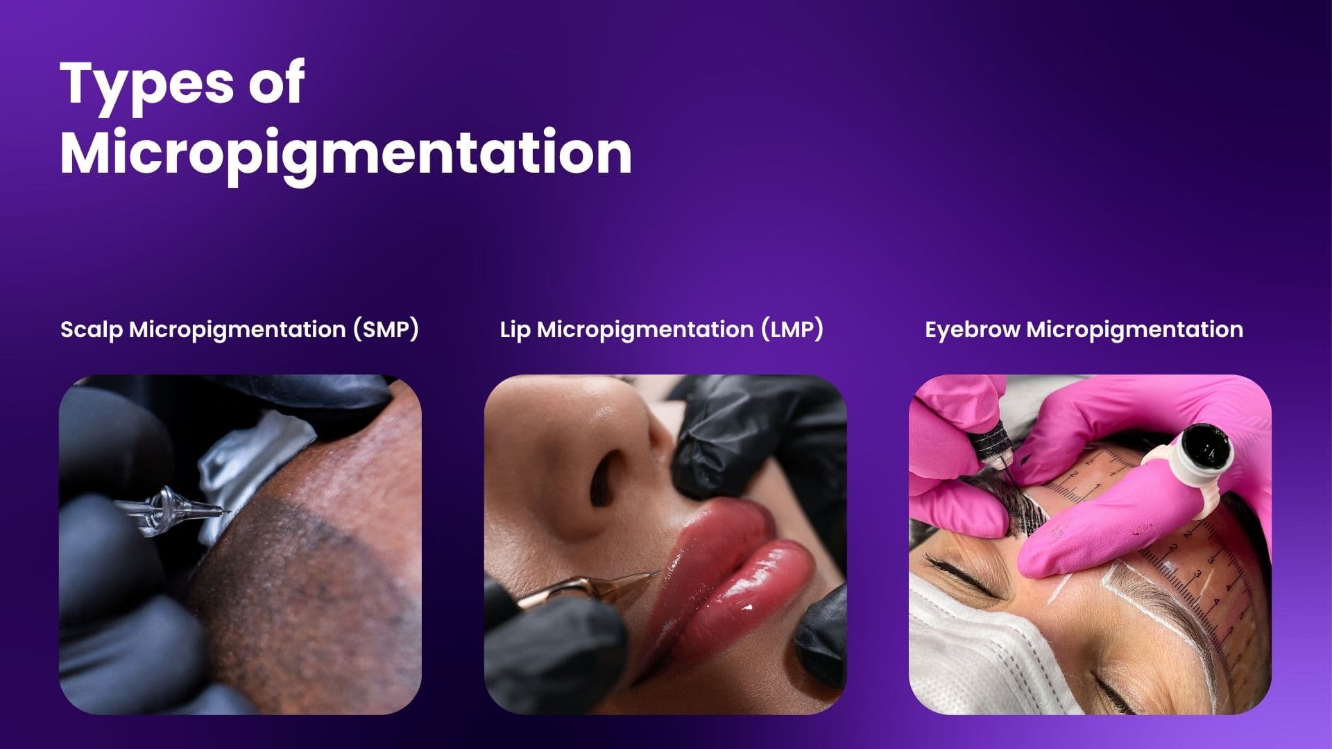 Image showing different types of micropigmentation offered at Trichos Hair Transplant Institute & Research Center in Hyderabad — including scalp micropigmentation, lip micropigmentation, and eyebrow micropigmentation.