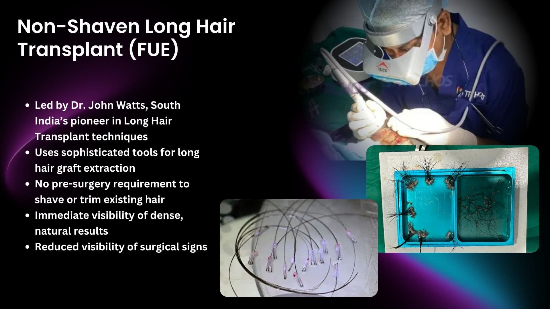 Dr. John Watts performing Non-Shaven Long Hair Transplant FUE in Hyderabad using advanced tools for long hair graft extraction with natural, dense results and no trimming required.